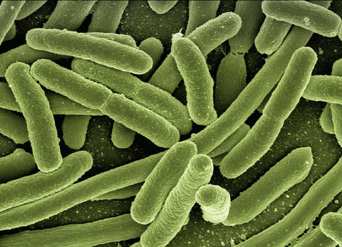 Autism Linked to Gut Bacteria | Probiotics Learning Lab